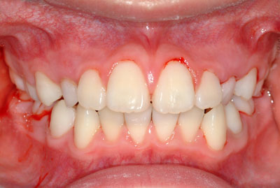 q̎,ς,,{,ϐF,iv,,,G.V. BLACK DENTAL OFFICE,GVBDO,