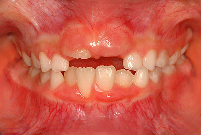 q̎,ς,,{,ϐF,iv,,,G.V. BLACK DENTAL OFFICE,GVBDO,