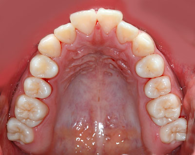 w,wN,q,񋸐,,Jn,,,摜,p,f, ,G.V. BLACK DENTAL OFFICE,GVBDO