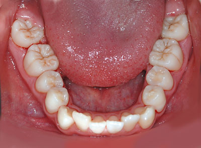 w,wN,q,񋸐,,Jn,,,摜,p,f, ,G.V. BLACK DENTAL OFFICE,GVBDO