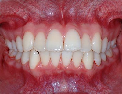 w,wN,q,񋸐,,Jn,,,摜,p,f, ,G.V. BLACK DENTAL OFFICE,GVBDO