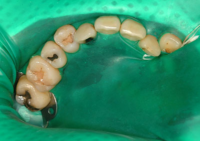 �A�}���K��,����,�Ď���,���o�[�_��,�摜,���s,���, ����,GVDBO,G.V. BLACK DENTAL OFFICE