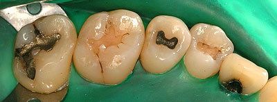 �A�}���K��,����,�Ď���,���o�[�_��,�摜,���s,���, ����,GVDBO,G.V. BLACK DENTAL OFFICE