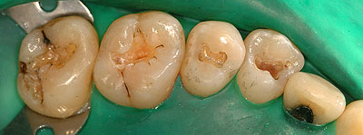 �A�}���K��,����,�Ď���,���o�[�_��,�摜,���s,���, ����,GVDBO,G.V. BLACK DENTAL OFFICE