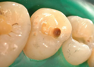 �A�}���K��,����,�Ď���,���o�[�_��,�摜,���s,���, ����,GVDBO,G.V. BLACK DENTAL OFFICE