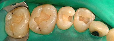 �A�}���K��,����,�Ď���,���o�[�_��,�摜,���s,���, ����,GVDBO,G.V. BLACK DENTAL OFFICE