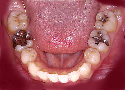 񋸐,s,],{֐ߏ,a,Ђ,soZ,,,,摜,b,GVBDO, G.V. BLACK DENTAL OFFICE