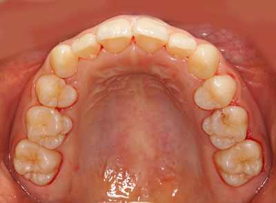 w,w,񋸐,,ւ,摜,10,11,12, 13,14, GVBDO,G.V. BLACK DENTAL OFFICE