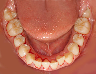 w,w,񋸐,,ւ,摜,10,11,12, 13,14, GVBDO,G.V. BLACK DENTAL OFFICE
