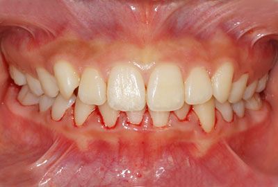 w,w,񋸐,,ւ,摜,10,11,12, 13,14, GVBDO,G.V. BLACK DENTAL OFFICE