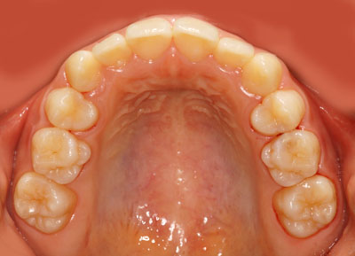 w,w,񋸐,,ւ,摜,10,11,12, 13,14, GVBDO,G.V. BLACK DENTAL OFFICE