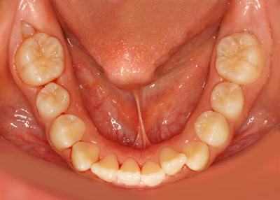 w,w,񋸐,,ւ,摜,10,11,12, 13,14, GVBDO,G.V. BLACK DENTAL OFFICE