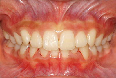 w,w,񋸐,,ւ,摜,10,11,12, 13,14, GVBDO,G.V. BLACK DENTAL OFFICE