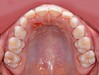 ,iv,ւ,,摜,W,X,10,11,GVBDO,G.V. BLACK DENTAL OFFICE