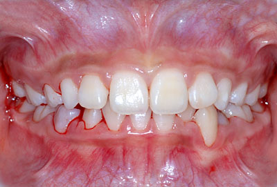 ,iv,ւ,,摜,W,X,10,11,GVBDO,G.V. BLACK DENTAL OFFICE