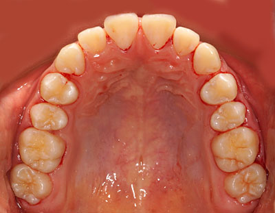 w,w,񋸐,,ւ,摜,10,11,12, 13,14, GVBDO,G.V. BLACK DENTAL OFFICE