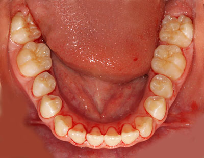 w,w,񋸐,,ւ,摜,10,11,12, 13,14, GVBDO,G.V. BLACK DENTAL OFFICE
