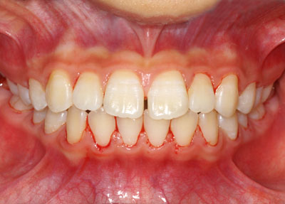 w,w,񋸐,,ւ,摜,10,11,12, 13,14, GVBDO,G.V. BLACK DENTAL OFFICE