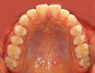w,w,񋸐,,ւ,摜,10,11,12, 13,14, GVBDO,G.V. BLACK DENTAL OFFICE