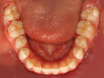 w,w,񋸐,,ւ,摜,10,11,12, 13,14, GVBDO,G.V. BLACK DENTAL OFFICE