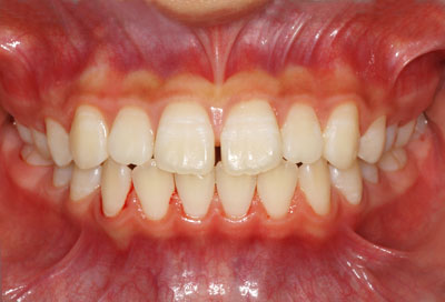 w,w,񋸐,,ւ,摜,10,11,12, 13,14, GVBDO,G.V. BLACK DENTAL OFFICE