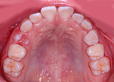 ,iv,ւ,,摜,W,X,10,11,GVBDO,G.V. BLACK DENTAL OFFICE