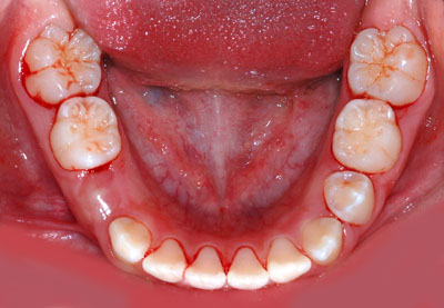,iv,ւ,,摜,W,X,10,11,GVBDO,G.V. BLACK DENTAL OFFICE