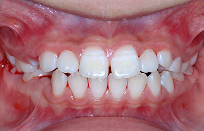 ,iv,ւ,,摜,W,X,10,11,GVBDO,G.V. BLACK DENTAL OFFICE