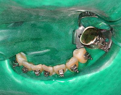 ���񋸐���,���ǎ���,�_�o,����,�摜,�A�}���K��,����,GVBDO,G.V. BLACK DENTAL OFFICE