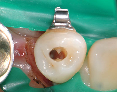 ���񋸐���,���ǎ���,�_�o,����,�摜,�A�}���K��,����,GVBDO,G.V. BLACK DENTAL OFFICE