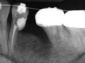 ���񋸐���,���ǎ���,�_�o,����,�摜,�A�}���K��,����,GVBDO,G.V. BLACK DENTAL OFFICE
