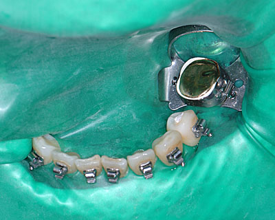 ���񋸐���,��������,��ꚐI,�摜,�A�}���K��,����, GVBDO,G.V. BLACK DENTAL OFFICE