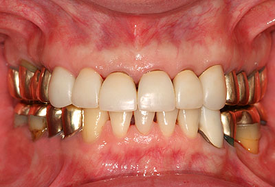 {֐ߏ,,,j,JC,ŊԔwjA,Ғǋ,łׂ,ŕ,_o,,,GVBDO,G.V. BLACK DENTAL OFFICE