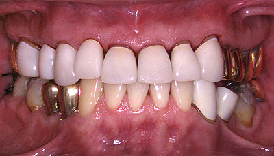 ���񋸐�,�u���P�b�g,���,����,������,�N���E��,����,G.V. BLACK DENTAL OFFICE,GVBDO,