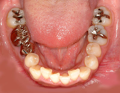 {֐ߏ,т̈,̂䂪,s,,É,,G.V. BLACK DENTAL OFFICE,GVBDO,