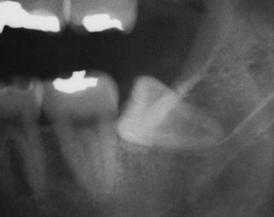 ���񋸐�,�e�m�炸,�����q��,����,����,�摜,����,GVBDO,G.V. BLACK DENTAL OFFICE